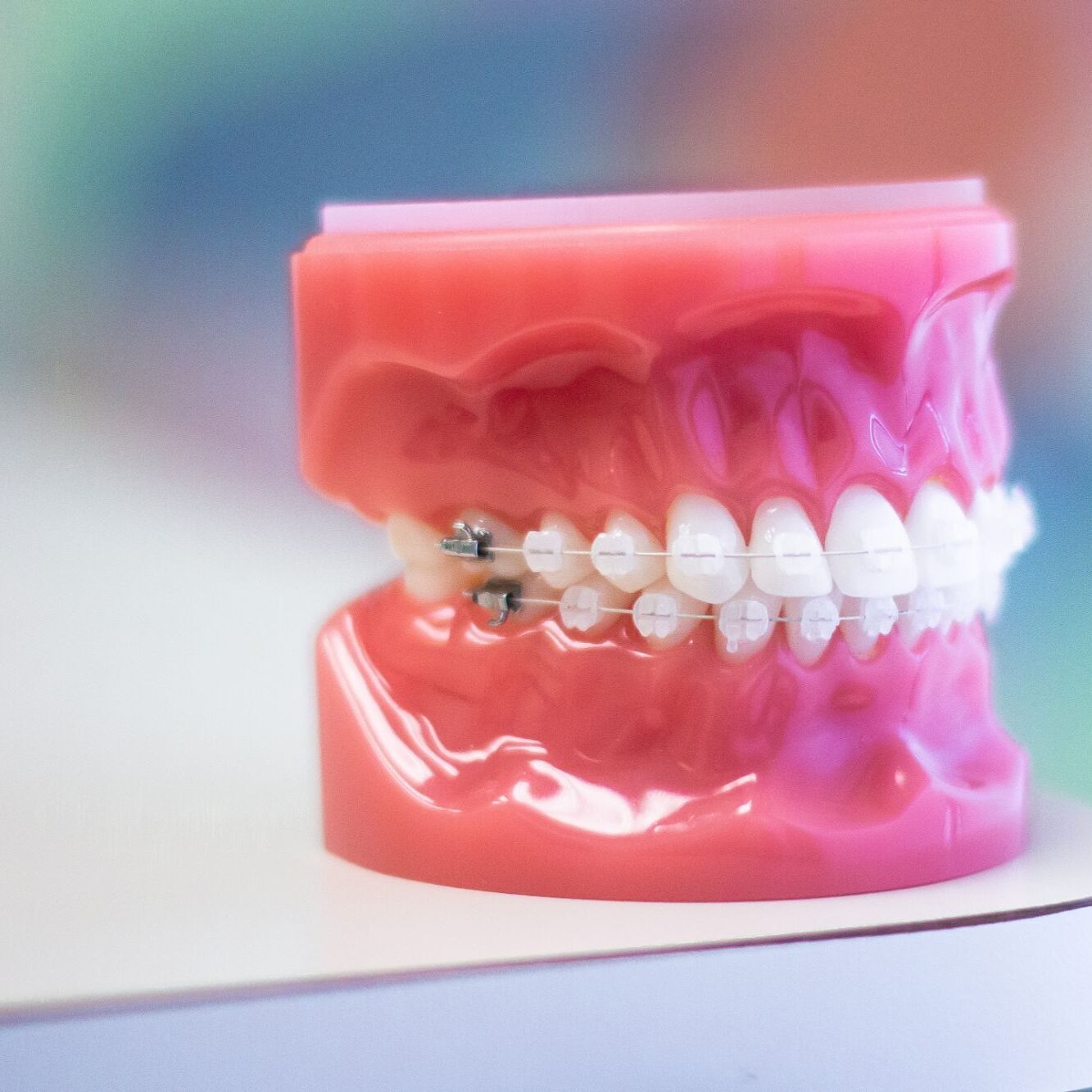 aw orthodontics clear braces